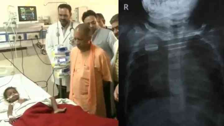 लखनऊ कोर्ट शूटआउट: सीएम योगी पहुंचे ट्रॉमा सेंटर, घायल बच्ची का जाना हालचाल, डॉक्टरों से ली मासूम के स्वास्थ्य की जानकारी