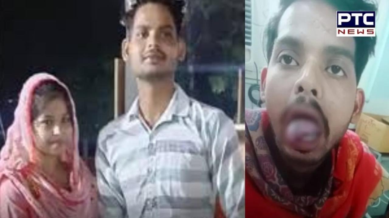 Ghaziabad में नवविवाहित महिला ने काटी अपने पति की जीभ, शराब पीने और इंस्टाग्राम पर रील बनाने से रोकता था..!